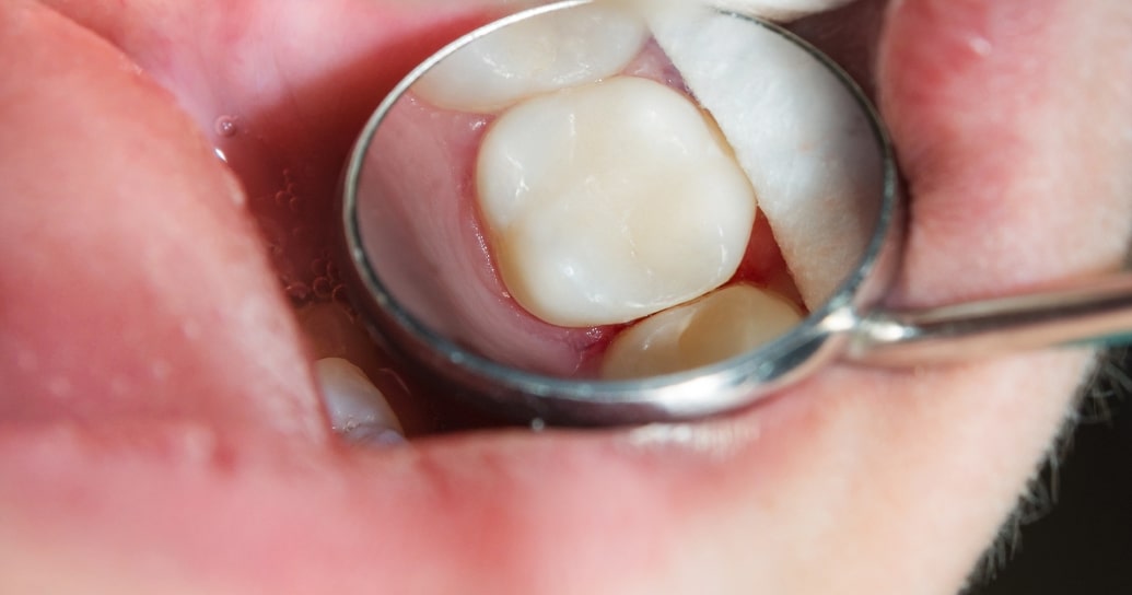 Treatment inner Parkview Dental